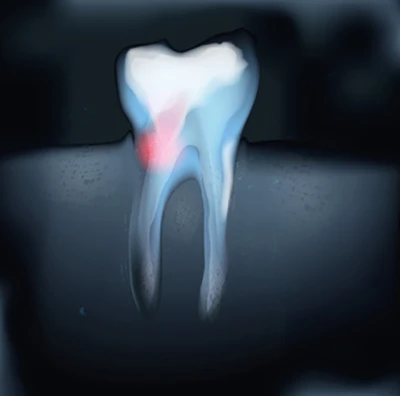 Endodoncja