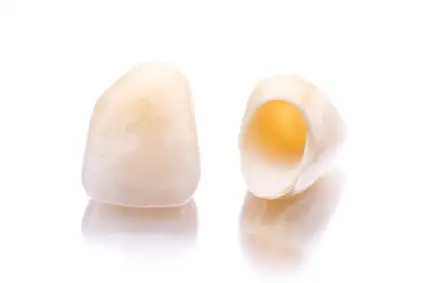 Korony ceramiczne
